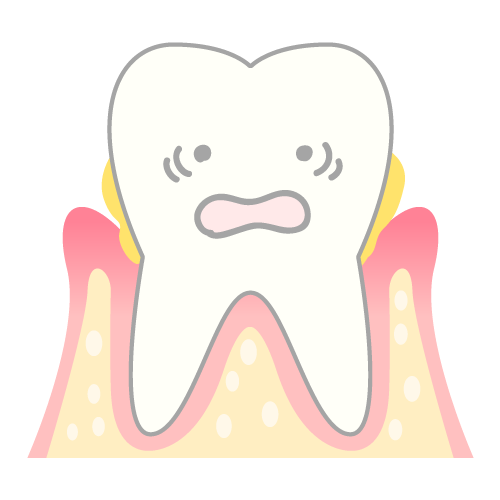 本当は恐い「歯周病」の話　～歯周病って治るの？～