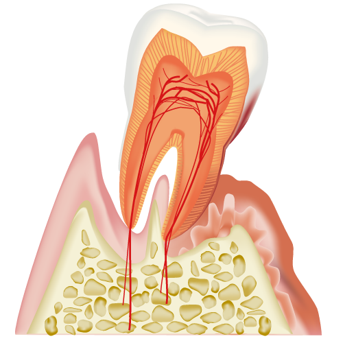 歯周病　原因　予防　年代別