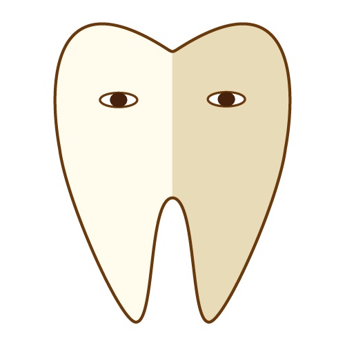 ホワイトニング　歯の黄ばみ　歯の黒ずみ　クリーニング　メインテナンス