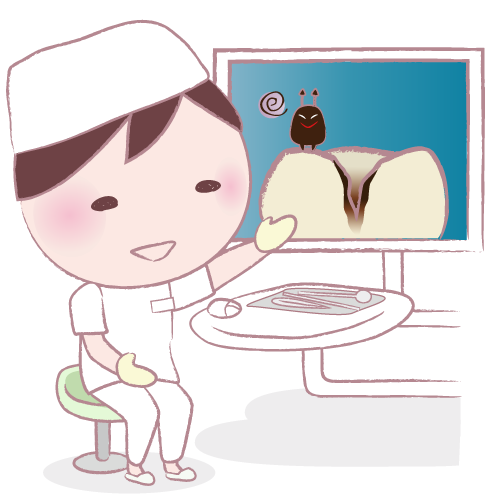 虫歯の進行速度はどれくらい?原因や対処法について解説