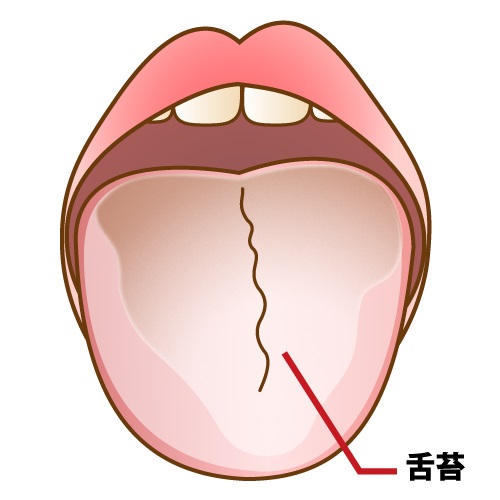 口臭の主な原因と効果的な予防策:今日から始める口腔ケア