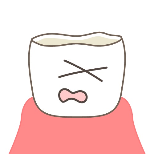 歯ぎしりの原因と治療法：歯やあごに与える影響とは