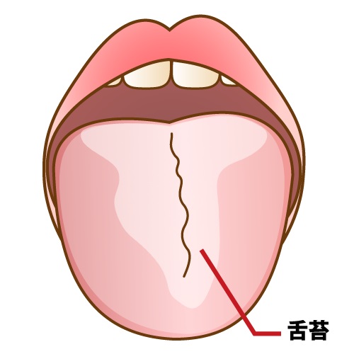 舌の汚れを防ぐ方法と口臭予防のための舌ケア
