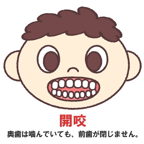 子どもの指しゃぶり、やめさせるべきタイミングと方法