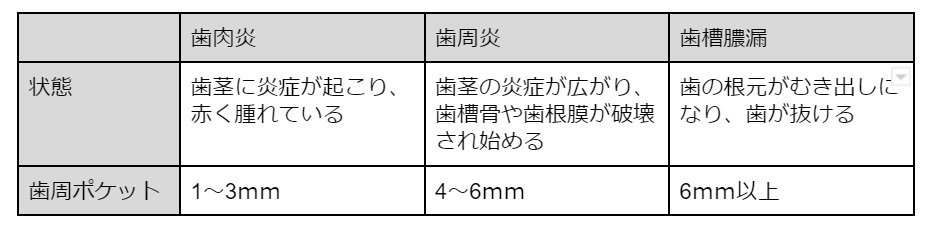 歯槽膿漏とは？歯肉炎、歯周炎との違いや症状、治療法を解説