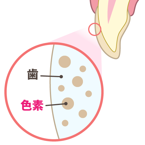 ホワイトニングの効果とは？持続時間の目安や長持ちさせる方法を解説