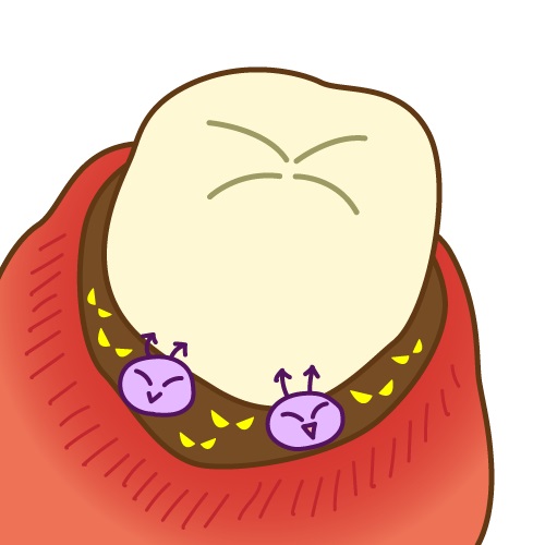 歯周ポケットの深さと歯周病の関係：原因と予防法を解説