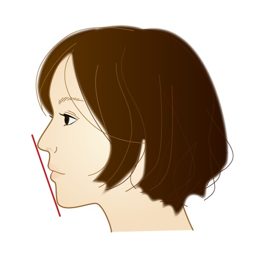 理想の歯並びを手に入れるための矯正治療ガイド