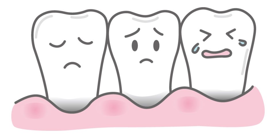 歯の磨きすぎによるリスクと正しいブラッシング方法