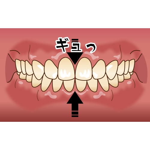 痛み止めが効かない歯の痛みの原因と対策を徹底解説