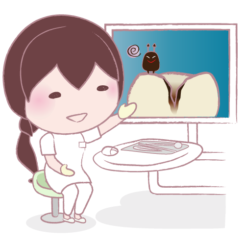 歯を削らない治療「MI(ミニマルインターベンション)」のメリットと注意点