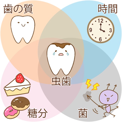 治療した歯の寿命と長持ちさせるためのポイント