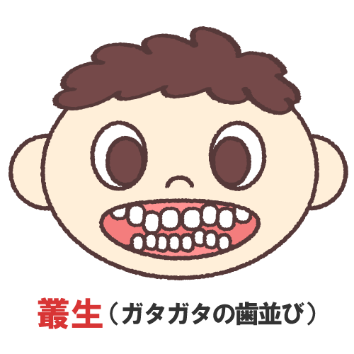二枚歯とは?乳歯が抜ける前に永久歯が生えてきた場合の注意点を解説