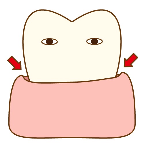 歯周ポケットの深さと歯周病の関係：原因と予防法を解説