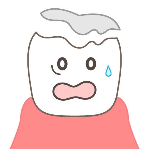 変色した歯の詰め物は交換できる？原因とセルフケアの方法