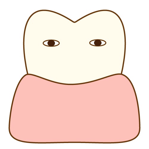 薬物性歯肉増殖症とは？症状・治療法・予防法を解説