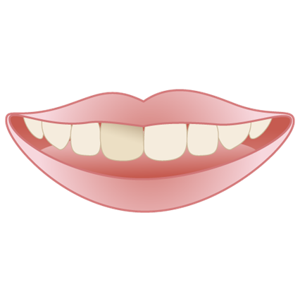 歯が黒いけど虫歯じゃない？考えられる原因と治療法まとめ