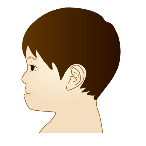 子どもの受け口は放置して大丈夫？原因と対応について解説